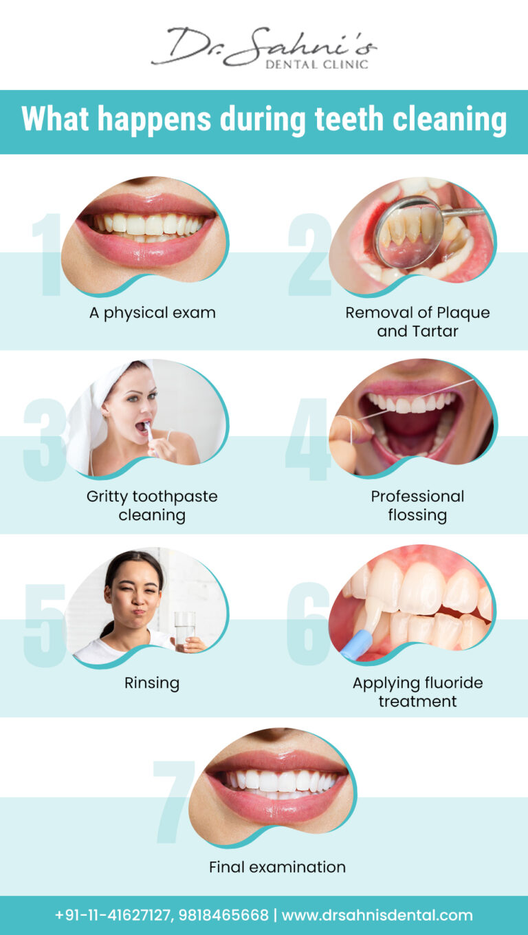 Teeth Cleaning: Myths V/S Facts | Dr Sahni Dental Clinic